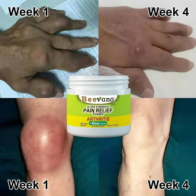 Bee Venom - Ultra Strength Pain Relief Cream 100gram (Pack of 2)